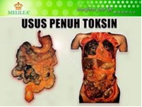 Usus Toxin